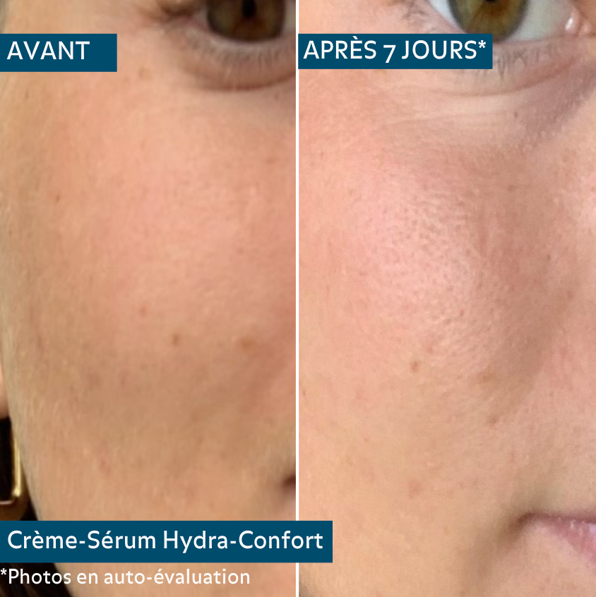 Crème-Sérum Hydra-Confort