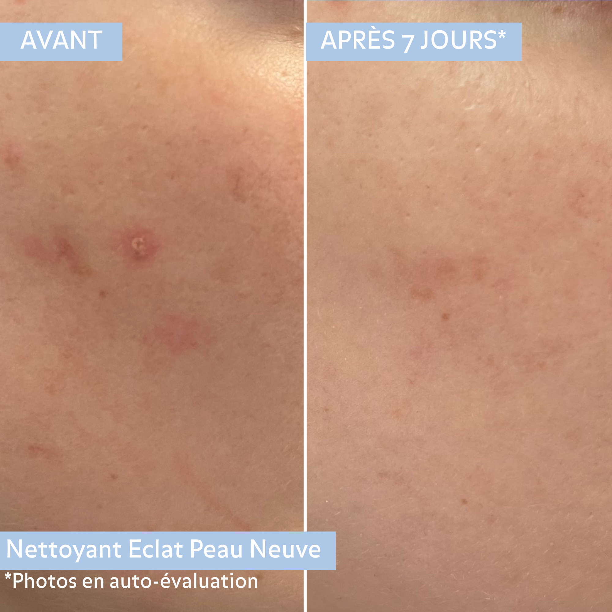 Nettoyant Éclat Peau Neuve