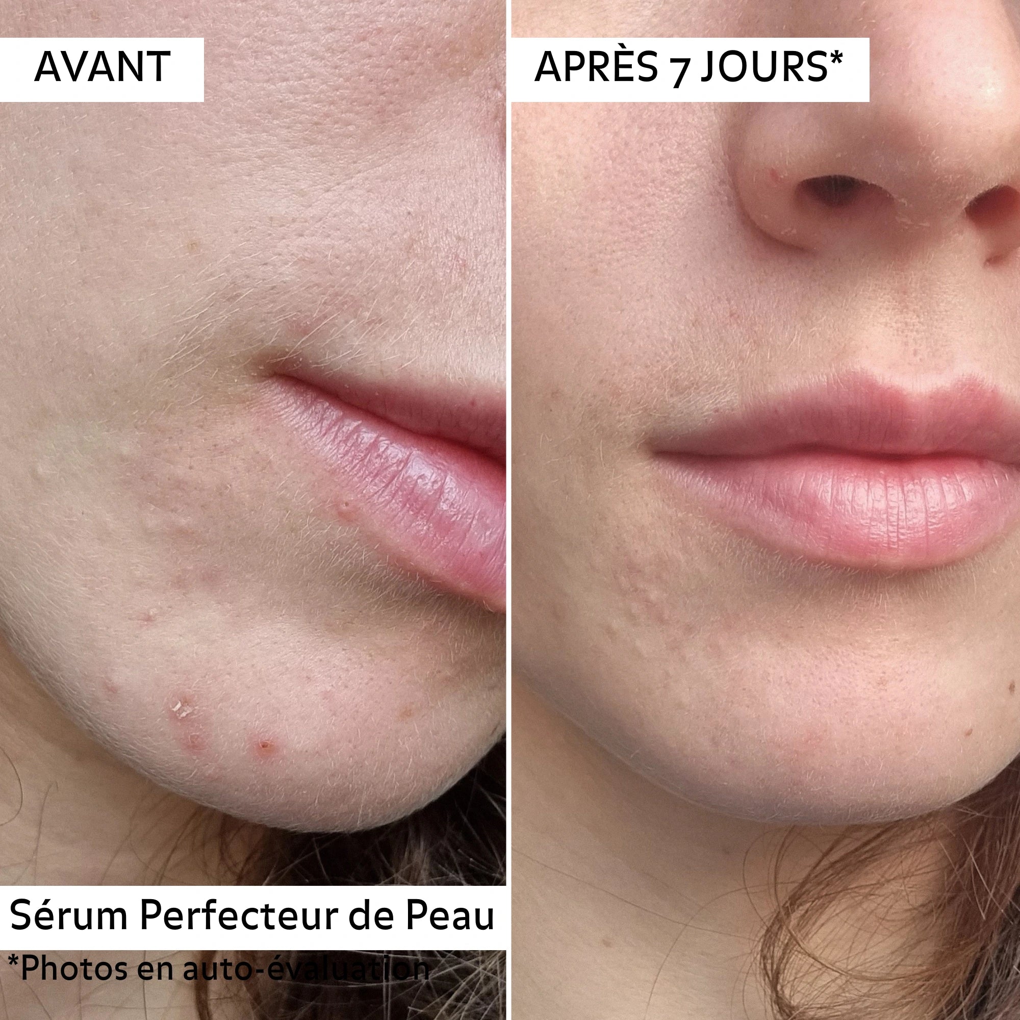 Avant / Après 7 jours d&