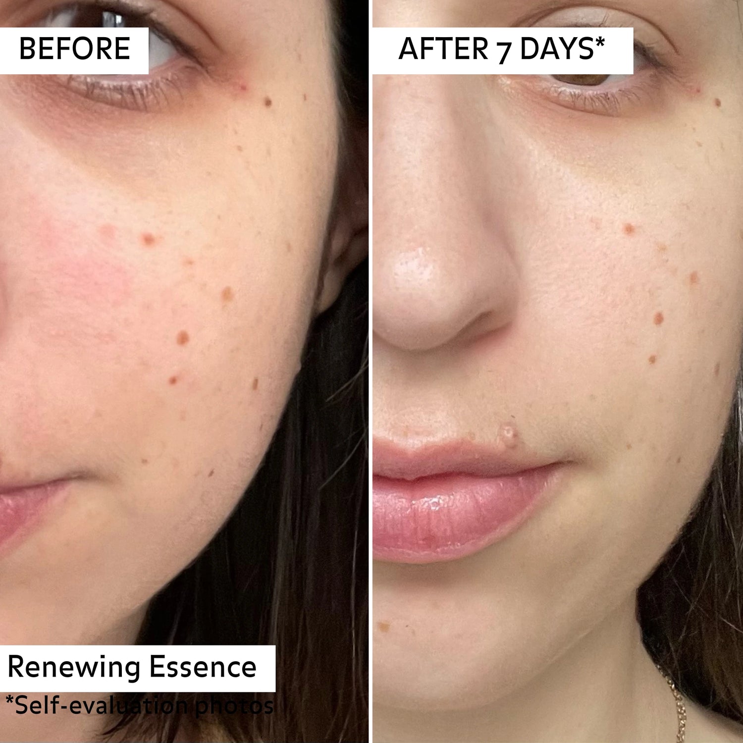 Avant/après 7 jours d’utilisation de l’essence régénérante Pureality : peau visiblement plus lisse, teint unifié et atténuation des taches.