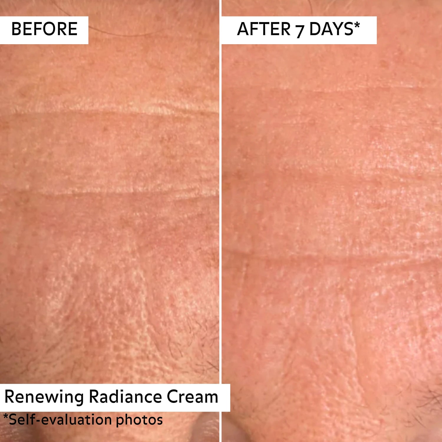 Poto avant/après 7 jours d&