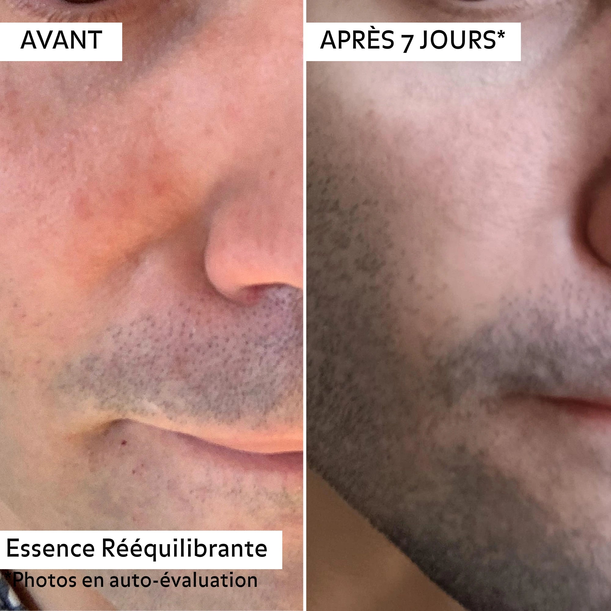 Avant/après 7 jours avec l’Essence Rééquilibrante Puréality : peau visiblement apaisée, moins rouge, plus lisse et plus uniforme.