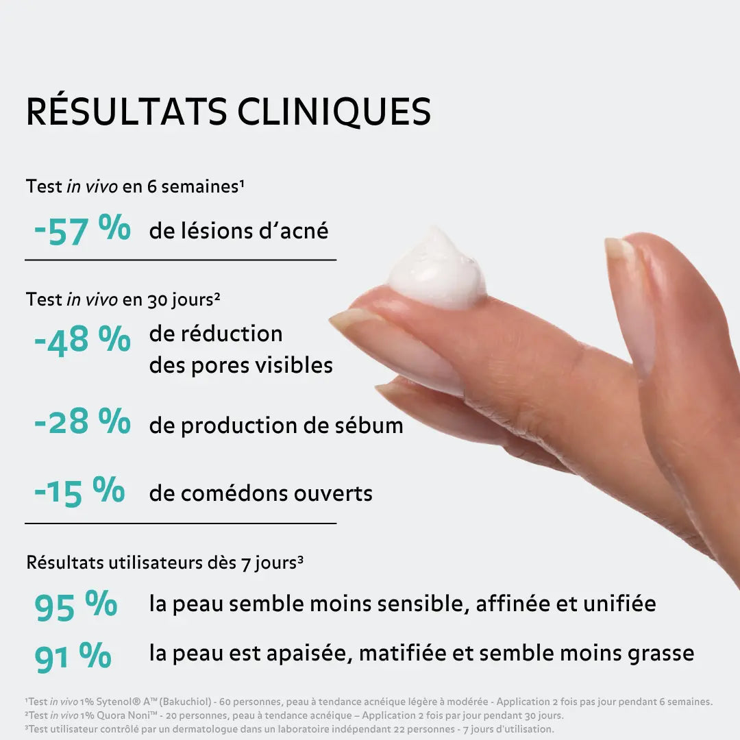 Résultats cliniques du sérum anti-imperfections Puréality montrant une diminution de l’acné, du sébum et des pores visibles