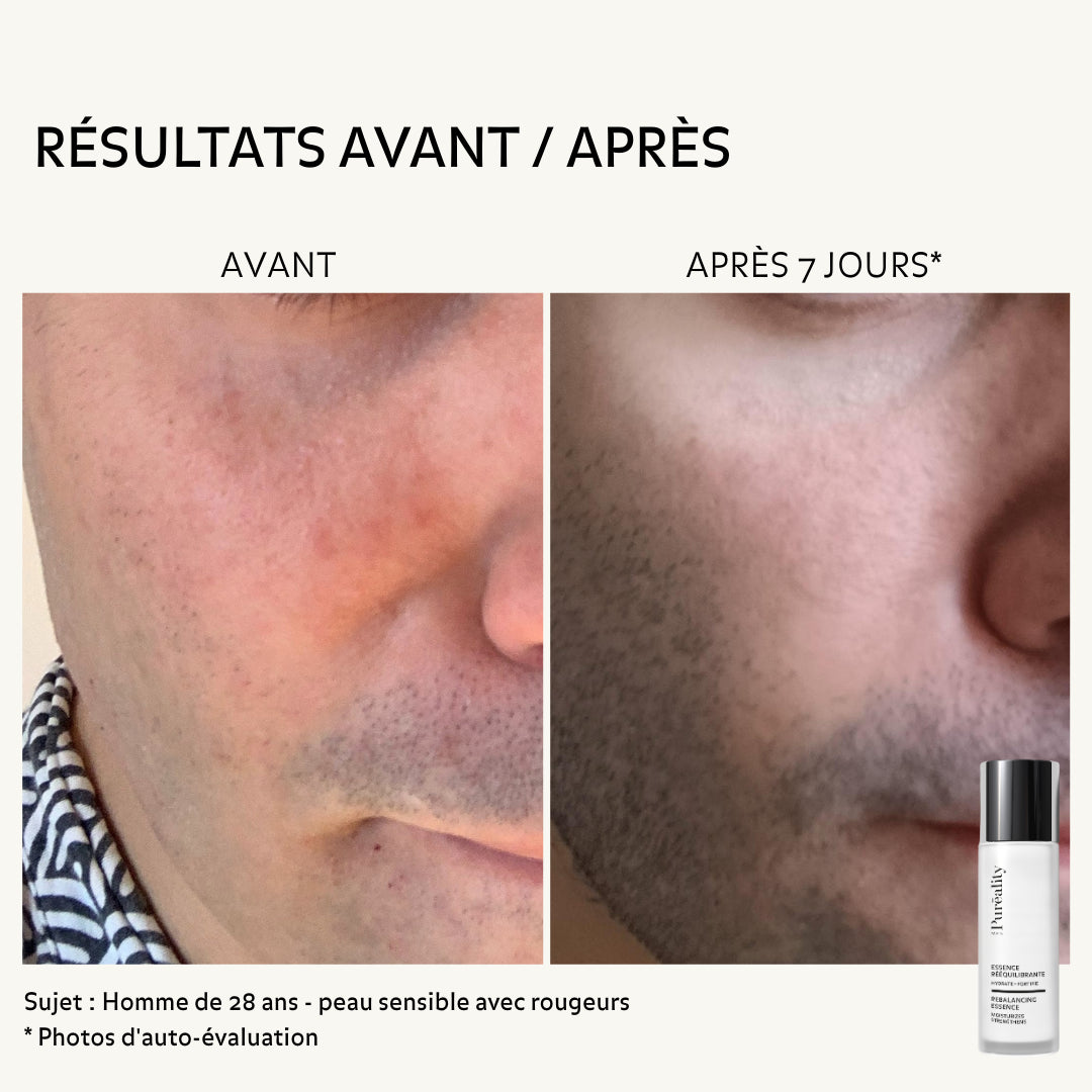 Résultats avant après de l&