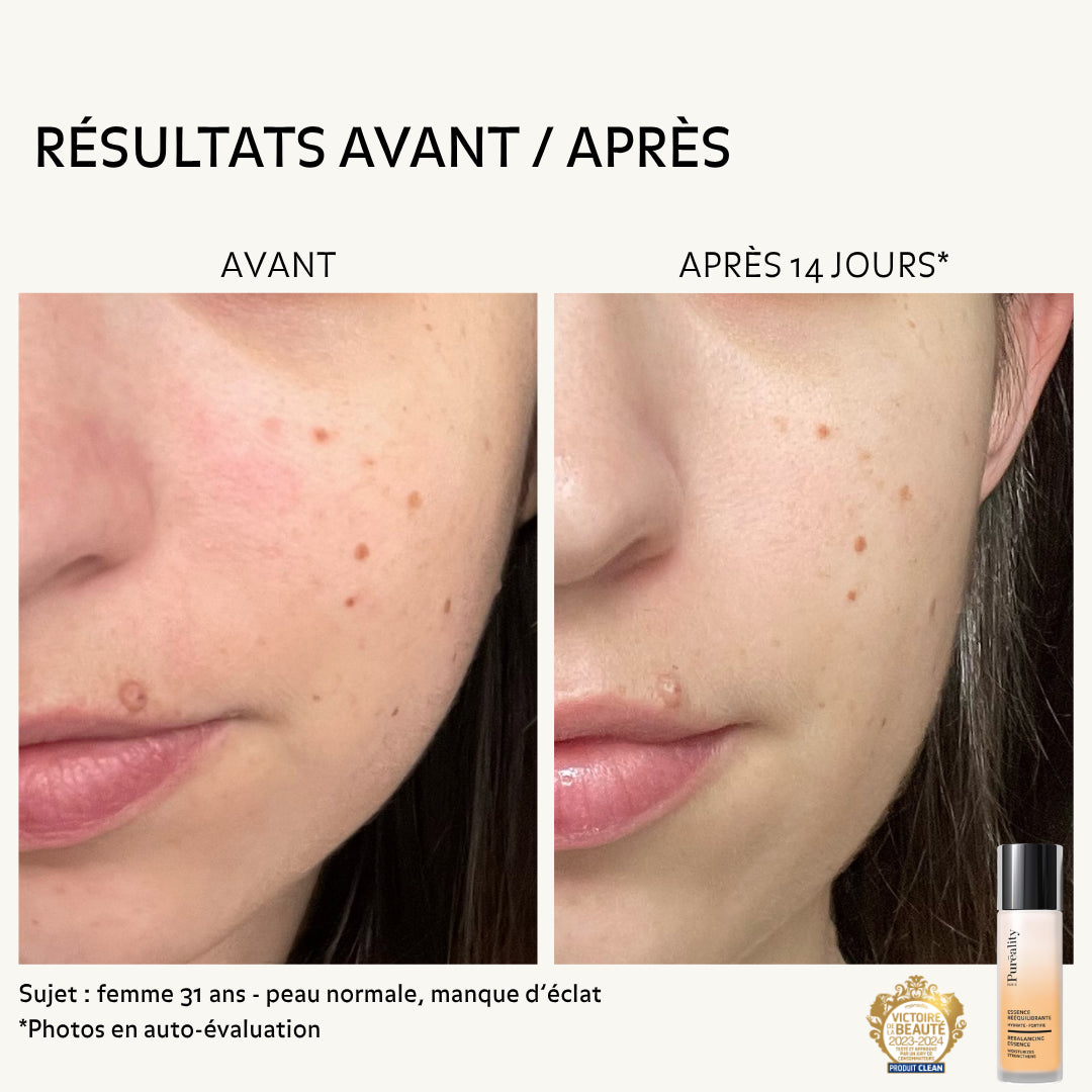 Résultats avant et après 14 jours de l&