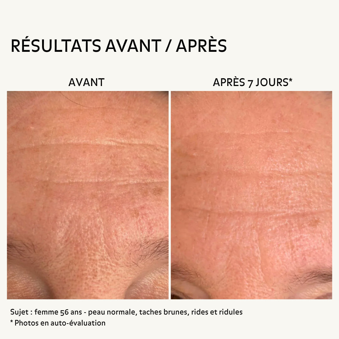 Avant après rides du front femme 56 ans après 7 jours d’utilisation d’un soin hydratant anti-âge Pureality montrant une peau plus lisse avec réduction des ridules et amélioration de la texture cutanée
