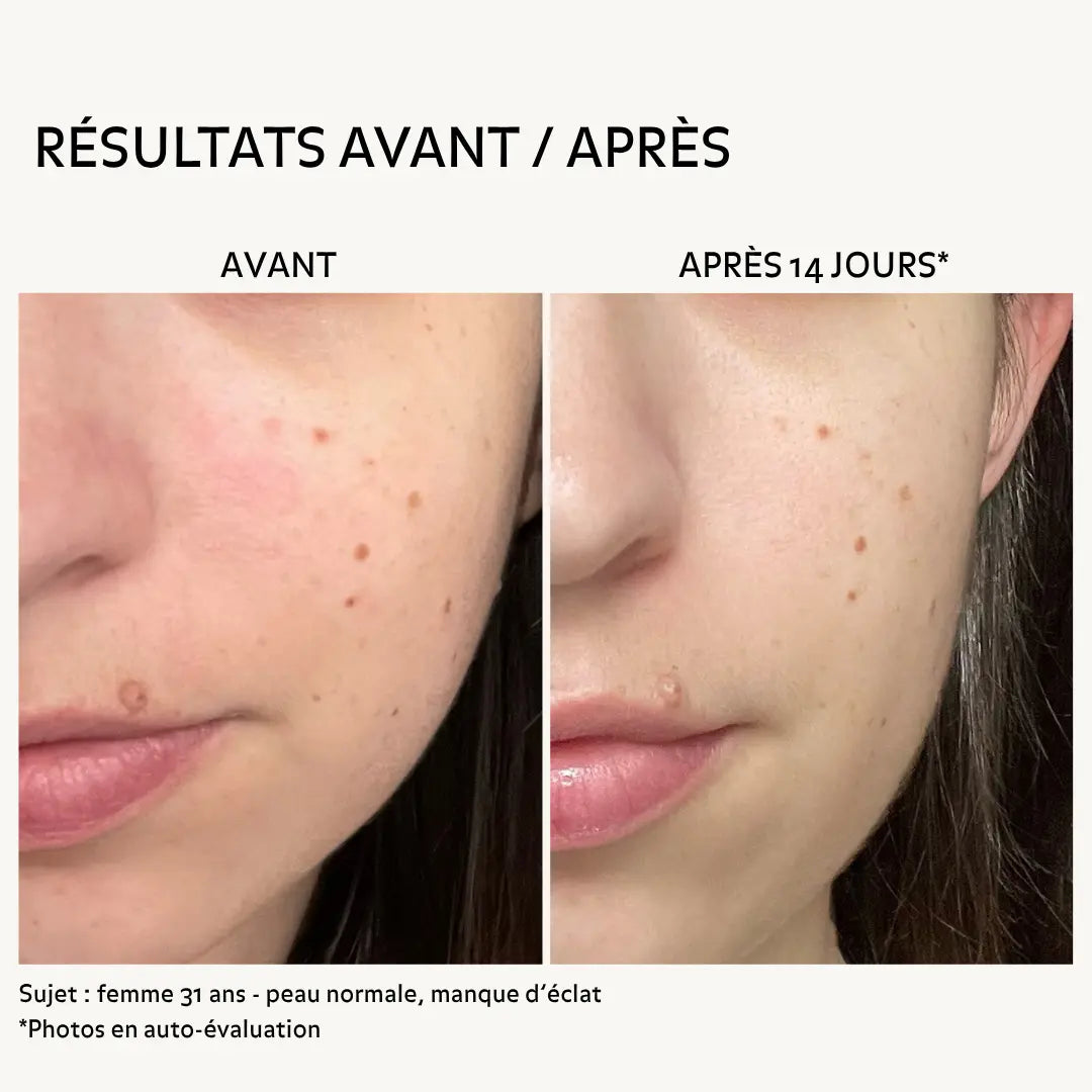 Avant après soin visage Puréality Paris montrant une peau plus lumineuse, lisse et uniforme après 14 jours avec le nettoyant éclat et l’essence régénérante