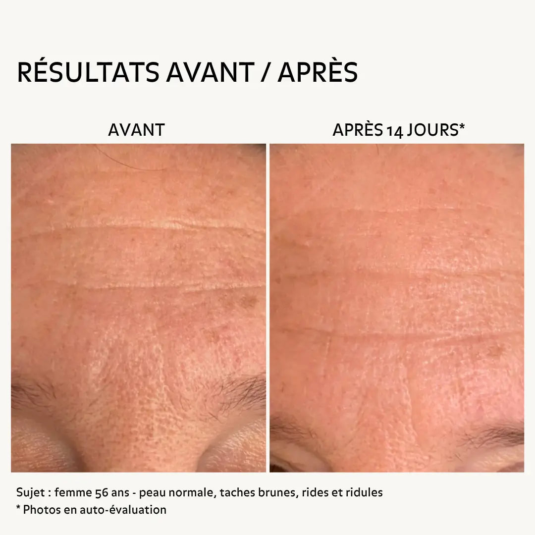 Avant après rides du front femme 56 ans après 14 jours avec routine éclat nettoyant essence et crème montrant peau plus lisse réduction des ridules grain de peau affiné et teint plus uniforme