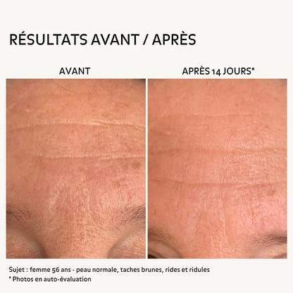 Avant après rides du front femme 56 ans après 14 jours avec routine éclat nettoyant essence et crème montrant peau plus lisse réduction des ridules grain de peau affiné et teint plus uniforme