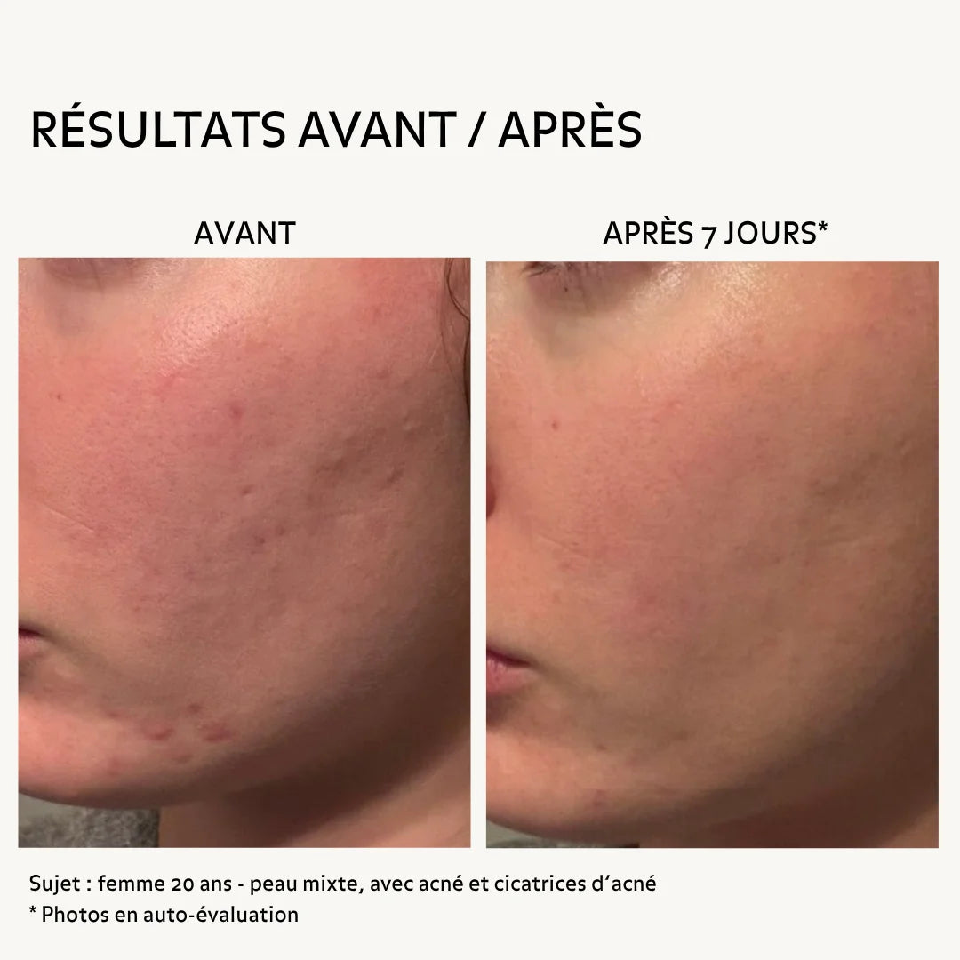 Résultas avant / après 7 jours