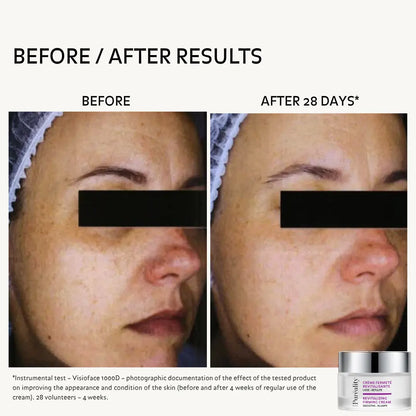 Facial comparison before and after 28 days of using Puréality Revitalising Firming Cream.