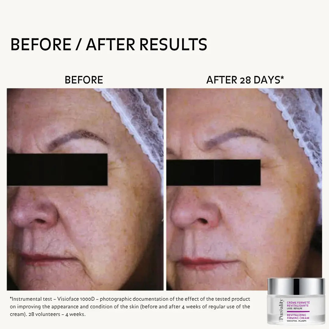 Facial results before and after 28 days of using Puréality Revitalising Firming Cream.