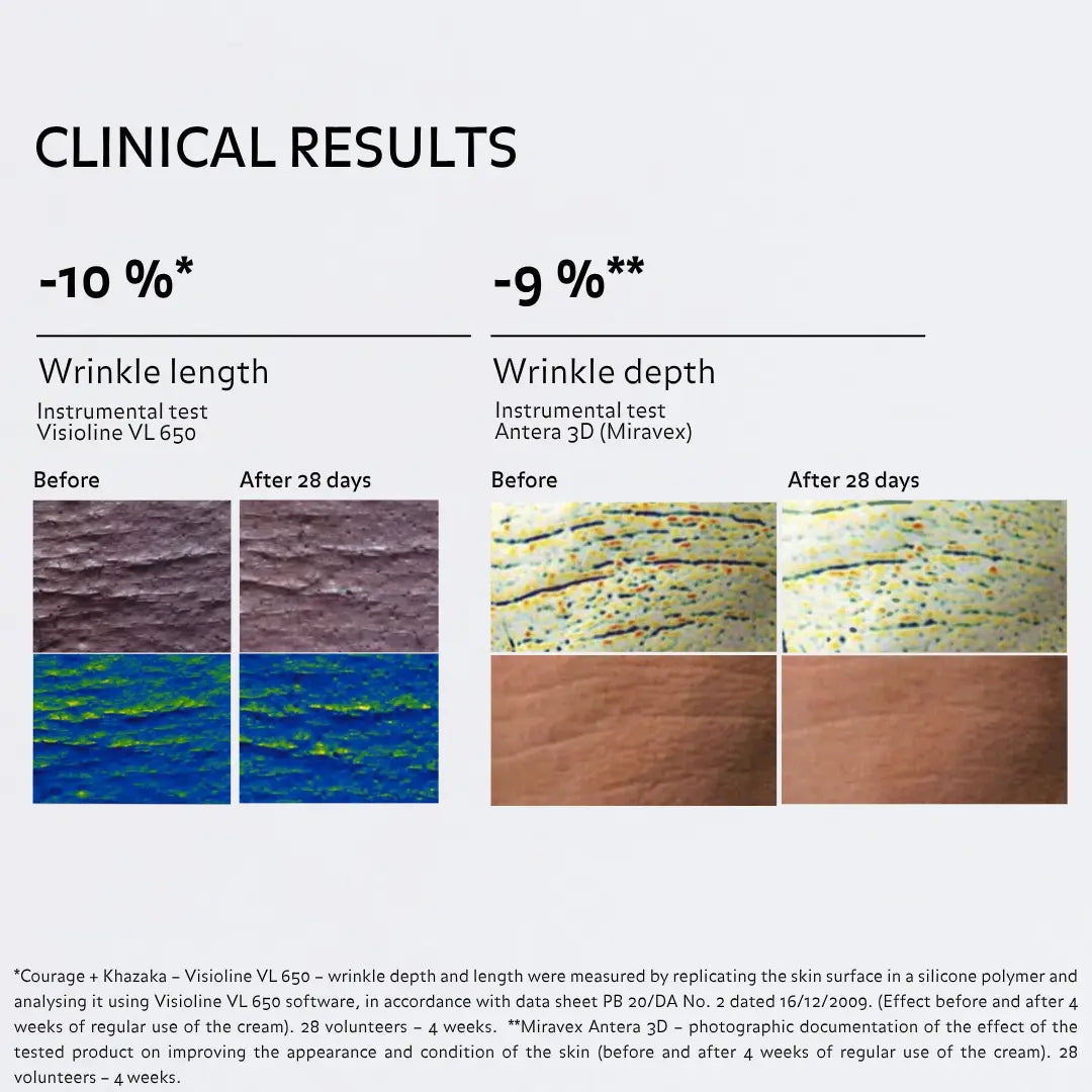Clinical results after 28 days showing a reduction in wrinkle length and depth.