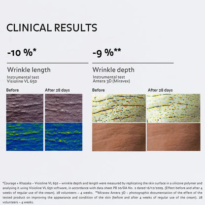 Clinical results after 28 days showing a reduction in wrinkle length and depth.