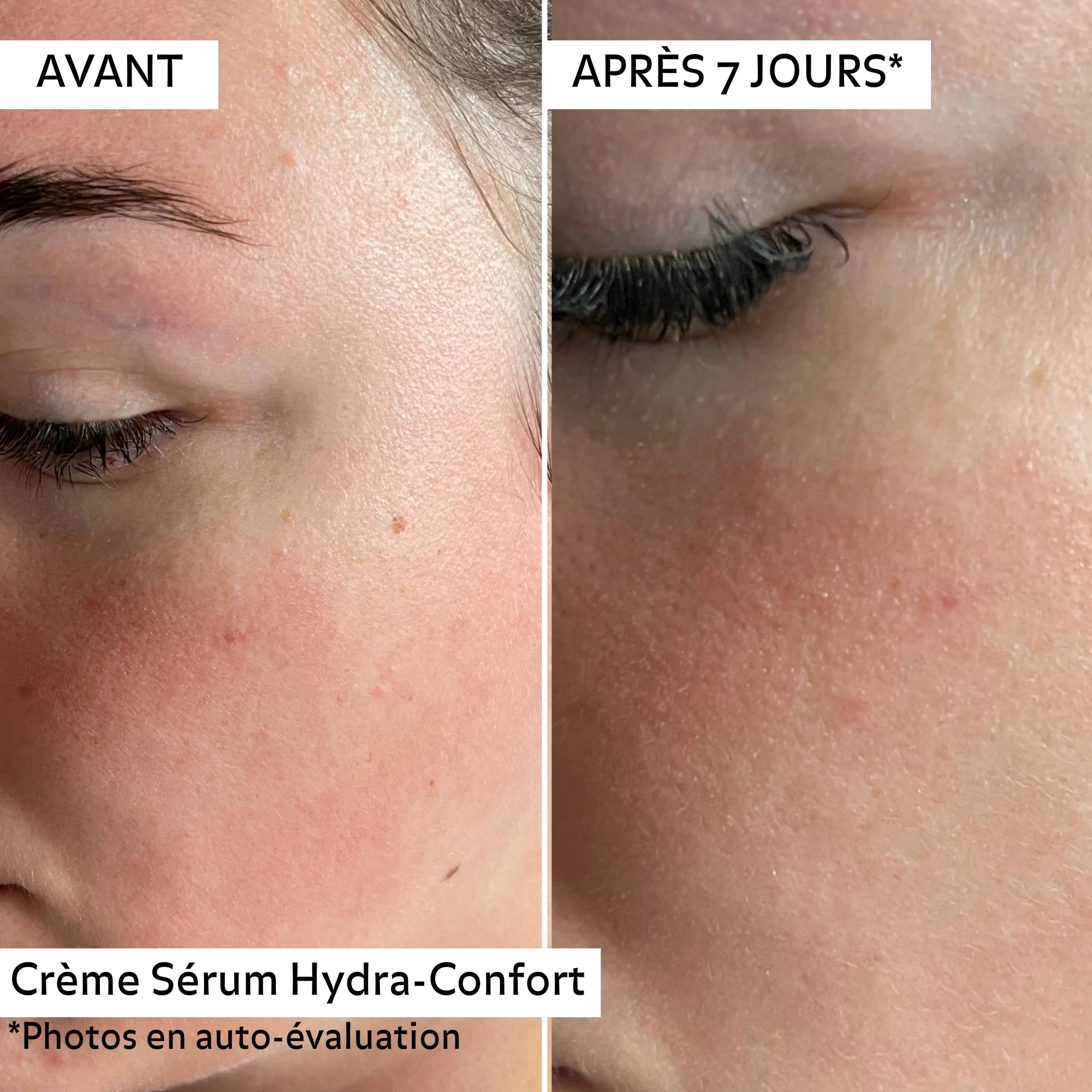 Avant/après 7 jours avec la Crème-Sérum Hydra-Confort Pureality : rougeurs visiblement apaisées, peau plus douce et confortable.