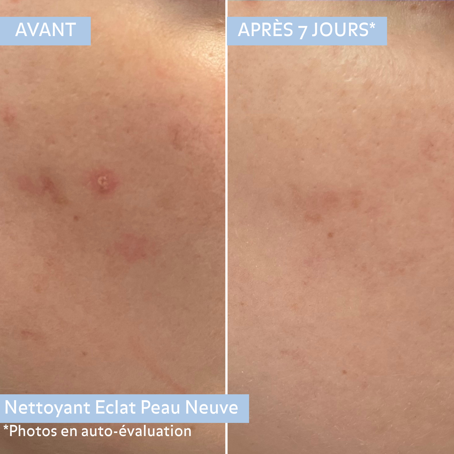 Nettoyant Éclat Peau Neuve
