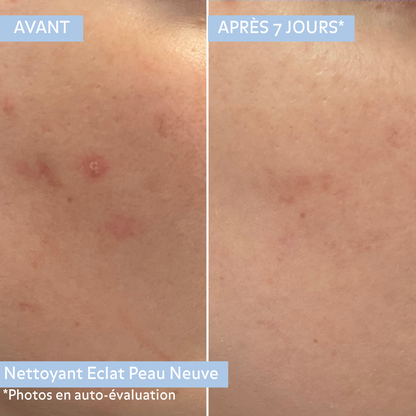Nettoyant Éclat Peau Neuve