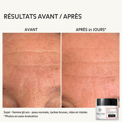 Image comparative avant/après d’un soin visage : deux gros plans du front d’une femme de 56 ans. À gauche (« avant »), peau avec rides, ridules et taches brunes visibles ; à droite (« après 21 jours »), peau plus lisse et uniforme avec rides atténuées. Mention indiquant qu’il s’agit de photos en auto-évaluation et précisant le type de peau. Produit « Puréality » visible en bas à droite.