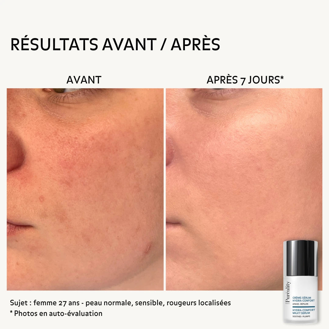 Hydra-Comfort Milky Serum