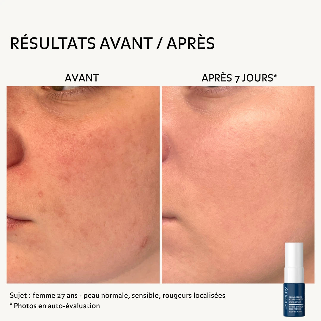 avant-apres-creme-serum-hydra-confort-8ml