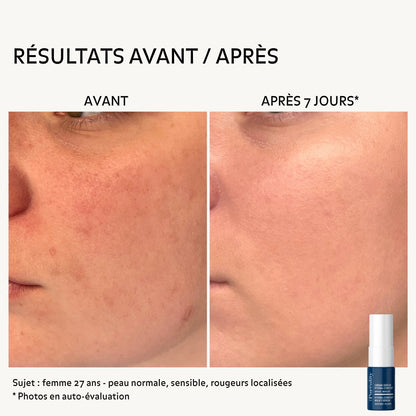 avant-apres-creme-serum-hydra-confort-8ml