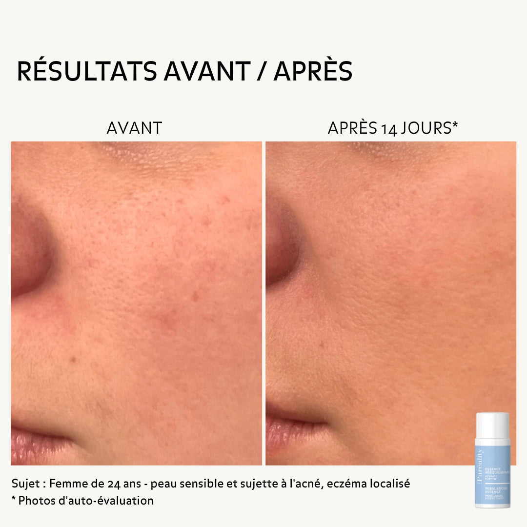 avant-apres-essence-reequilibrante