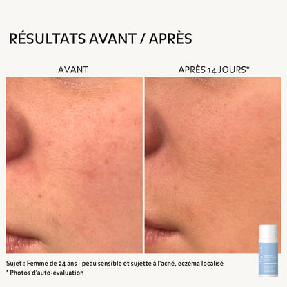 avant-apres-essence-reequilibrante