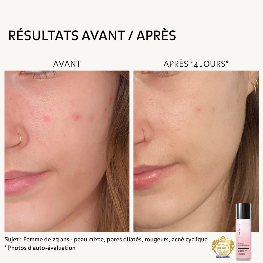 Résultats avant et après 14 jours de l&