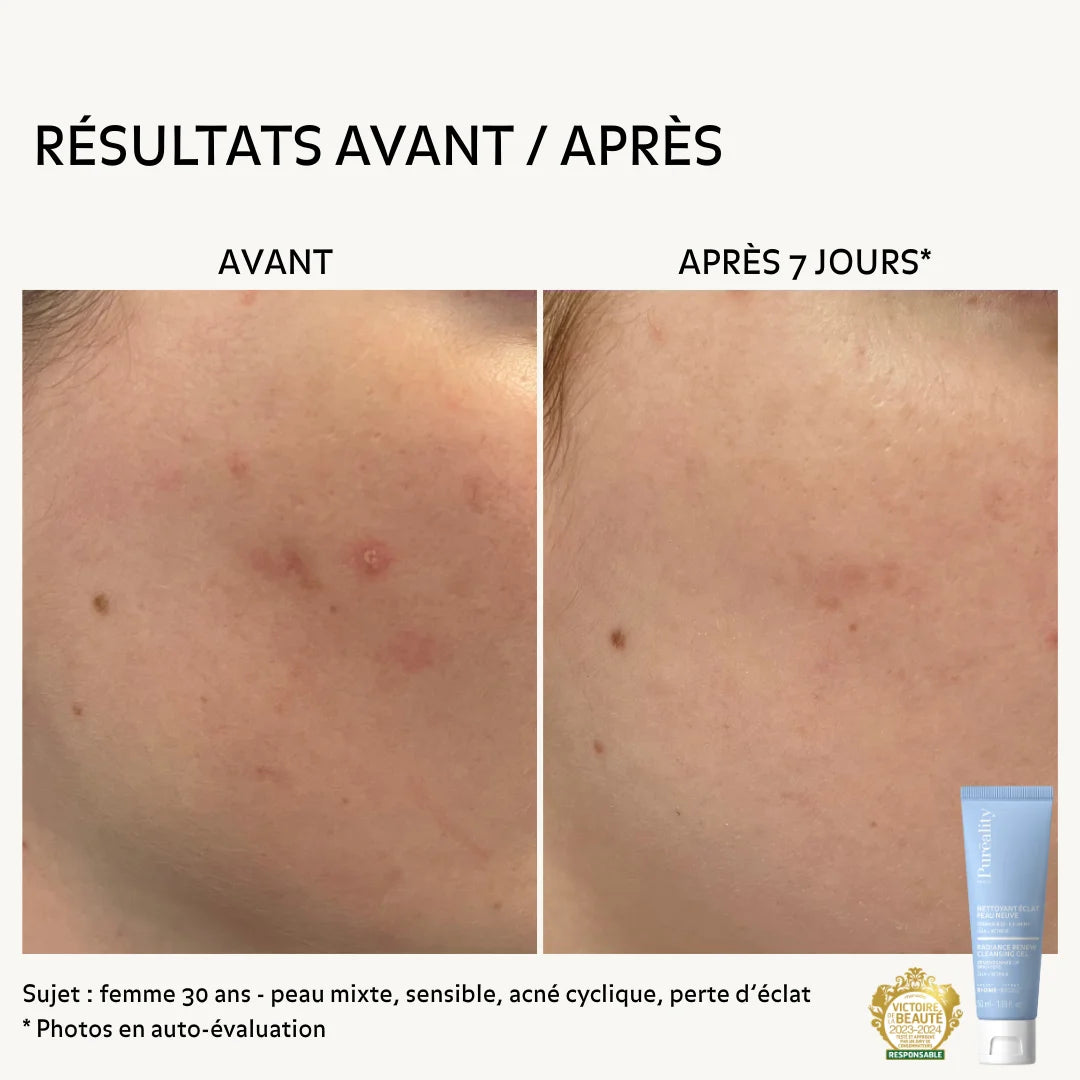 Résultats avant après du Nettoyant Eclat Peau Neuve après 7 jours d&