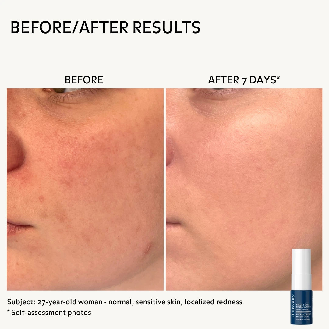 before-after-hydra-comfort-milky-serum-8ml