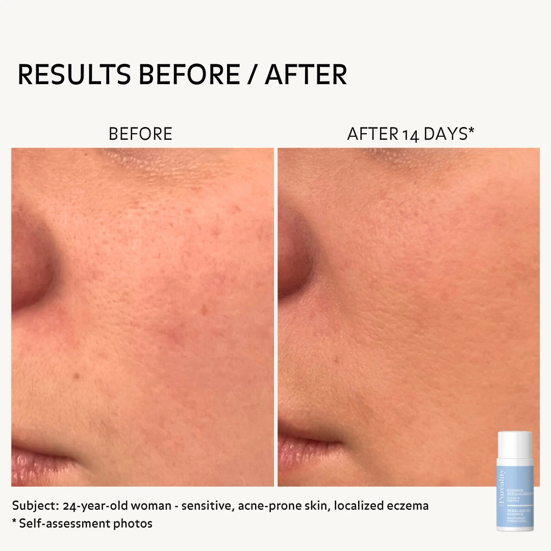 before-after-rebalancing-essence