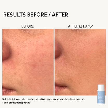 before-after-rebalancing-essence