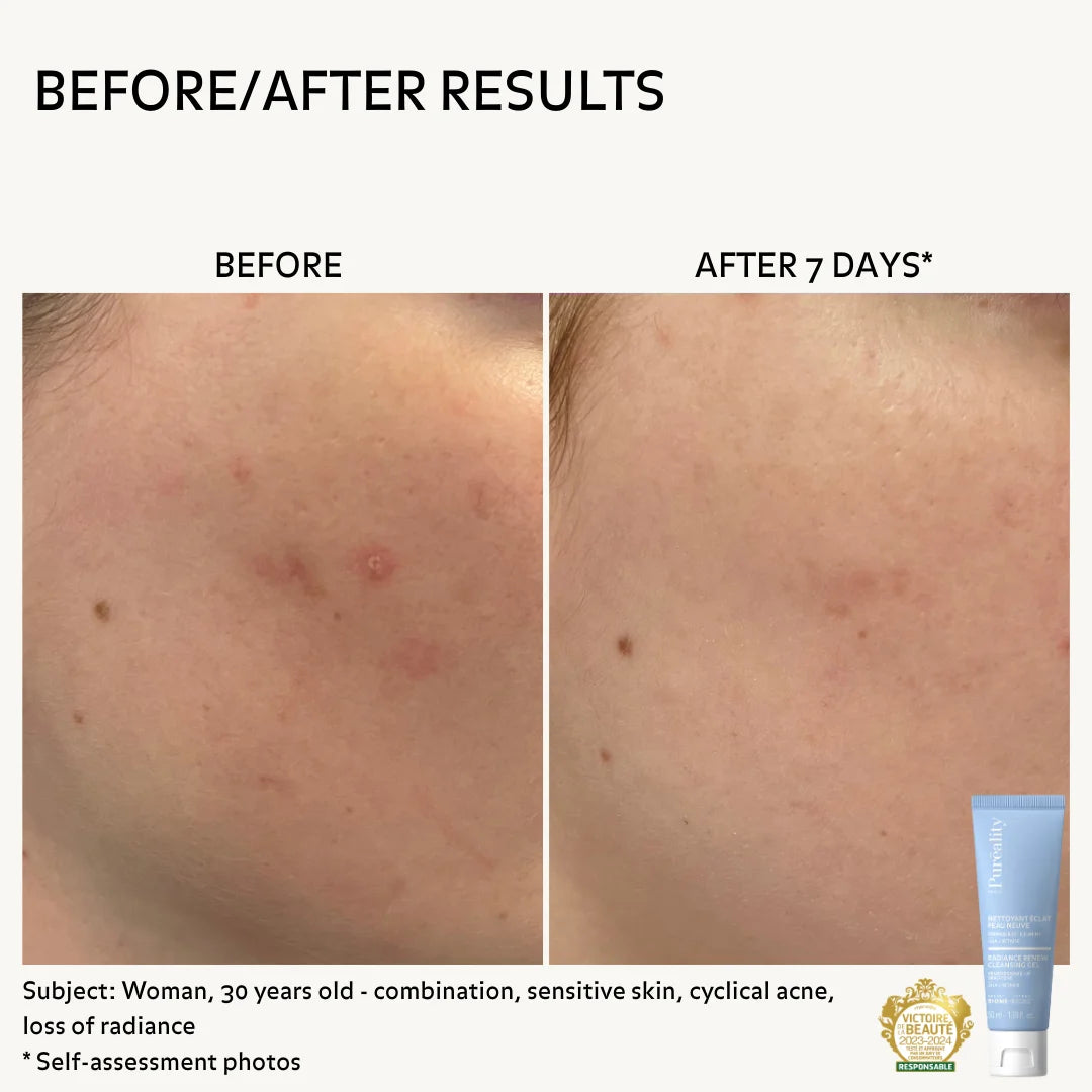 Before After 7 days of use