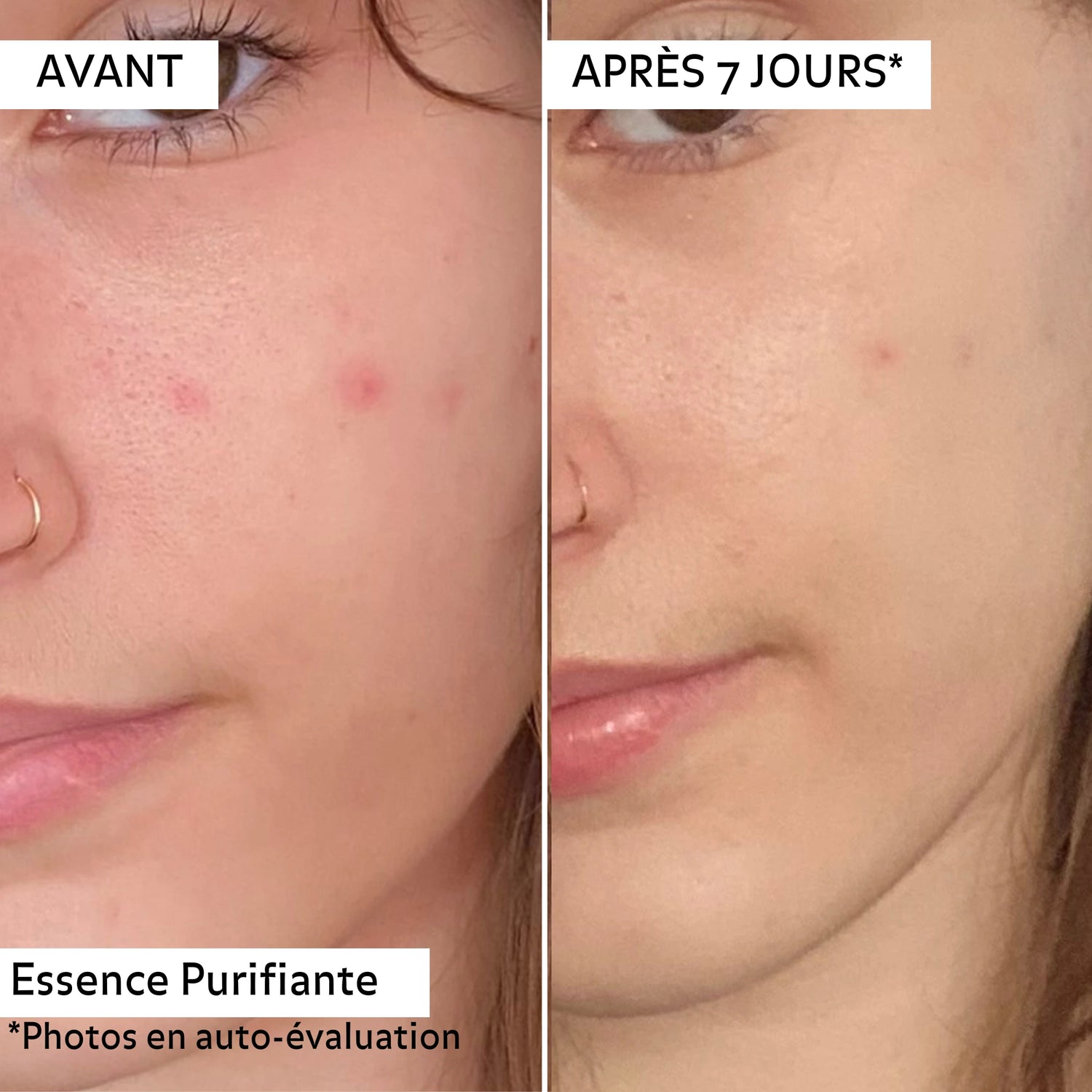 Avant/après 7 jours de l&