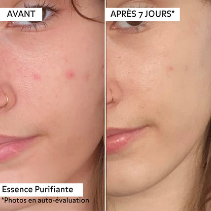 Avant/après 7 jours de l&