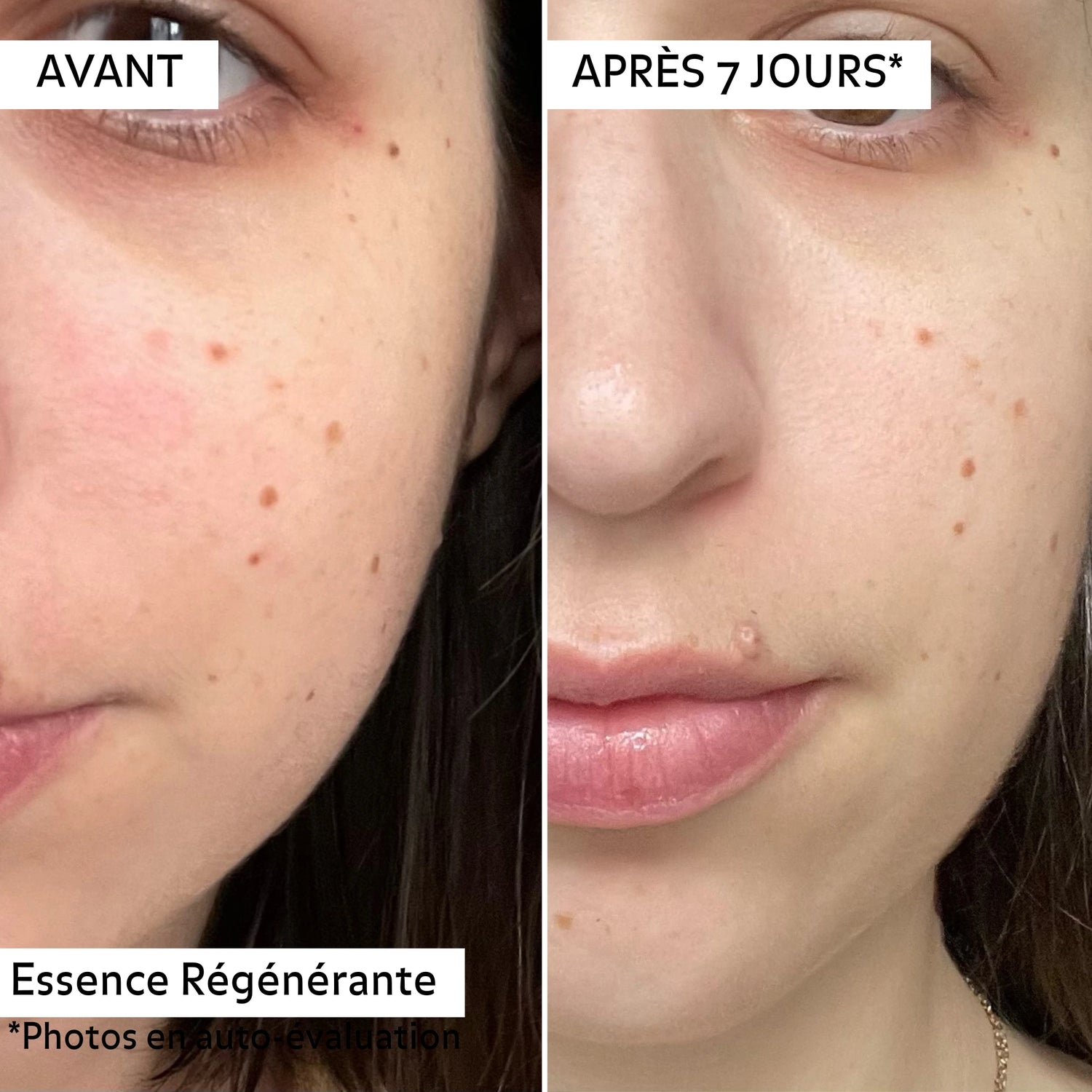 Avant/après 7 jours d’utilisation de l’essence régénérante Pureality : peau visiblement plus lisse, teint unifié et atténuation des taches.