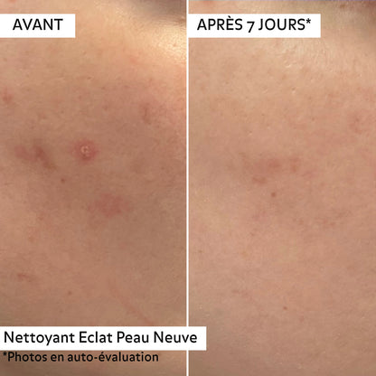 Avant/après 7 jours avec le Nettoyant Éclat Peau Neuve Puréality : peau visiblement purifiée, plus lisse et grain de peau affiné.
