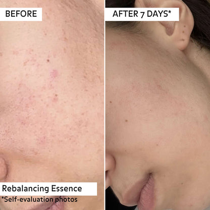 Avant/Après 7joiurs d&